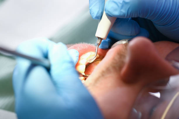 Best Pediatric Emergency Dentist in Rockville Centre, NY