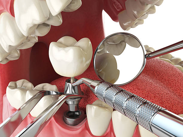 Best Emergency Dental Services for Seniors in Rockville Centre, NY